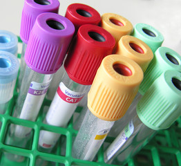 tubes
