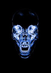 skull x ray