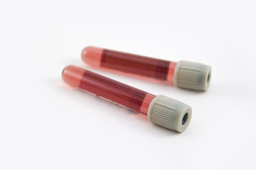tubes with liquid samples