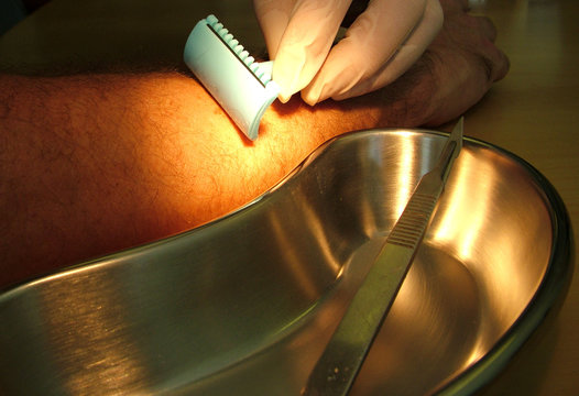 medical shave