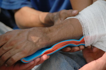 broken wrist