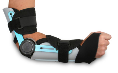 broken arm in a cast