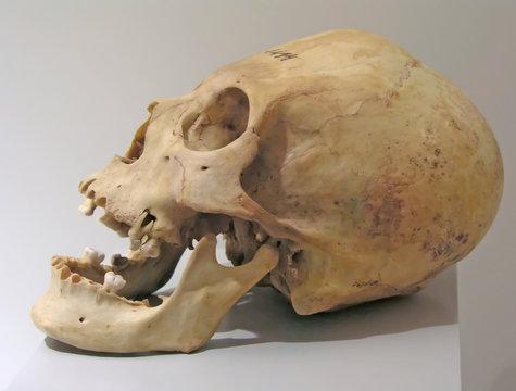 prehistoric skull
