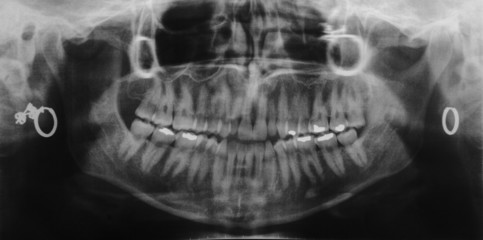 dentist x-ray