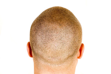 head
