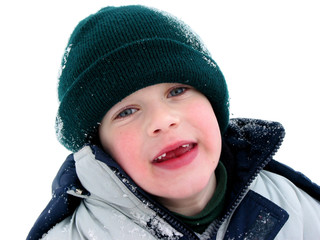 missing teeth