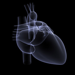 heart x-ray 1