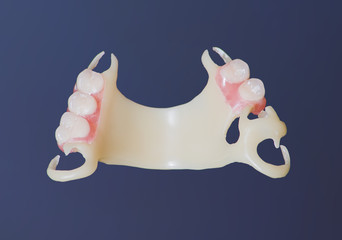 denture