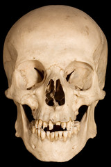 human braincase