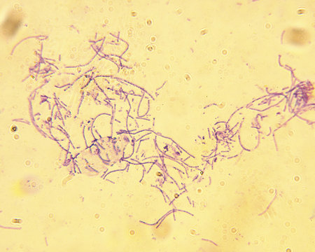 microscope-anthrax-bacillus anthracis