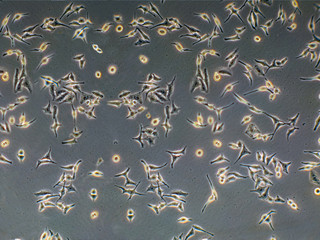 cervical cancer cells