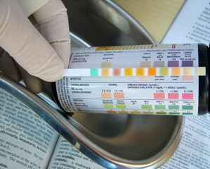 urine test