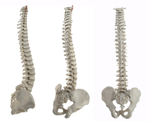 three spines - 1249863