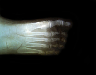 x-ray picture