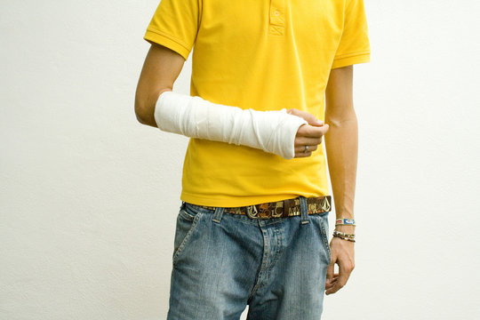 arm in gips