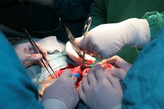surgery, laryngectomy