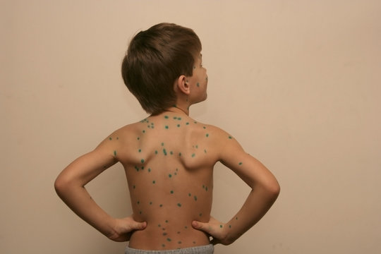 boy with green dots