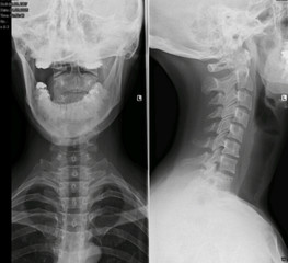 röntgenaufnahme