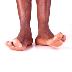 pieds