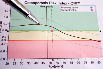 pen showing diagram on osteoporosis risk