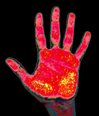 thermal hand