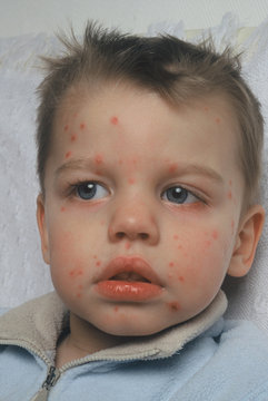 enfant malade