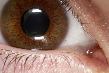eyeball