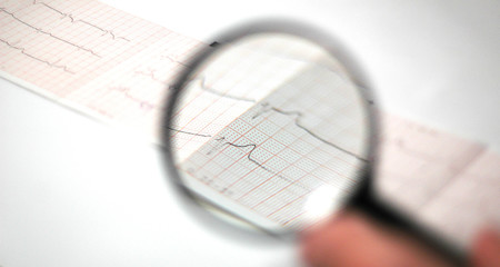 cardiogram  watched  threw the magnifying glass