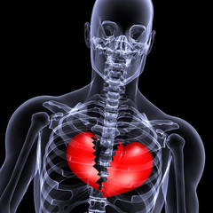 skeleton x-ray broken heart 1