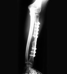 x-ray of forearm