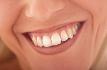 sorriso
