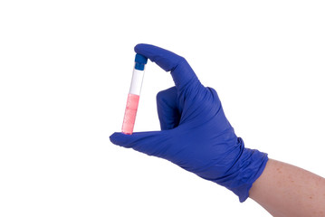 medical scientist holding a test tube
