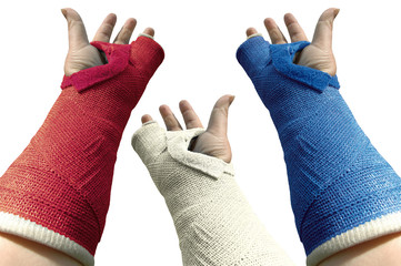 three arms in plaster 1