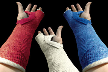three arms in plaster 2