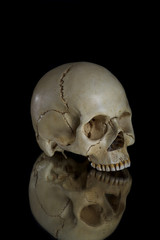 cranium