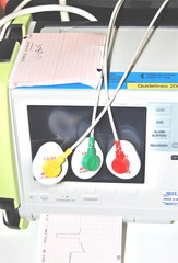 ecg