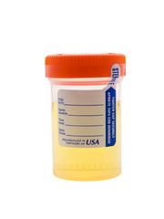 urine sample