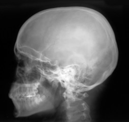x-ray profile