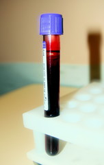 blood