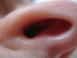 nase