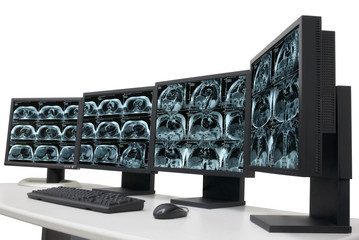 magnetic resonance images on monitors
