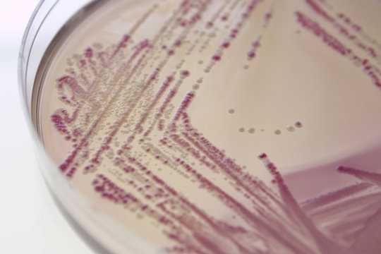 bacterial colonies