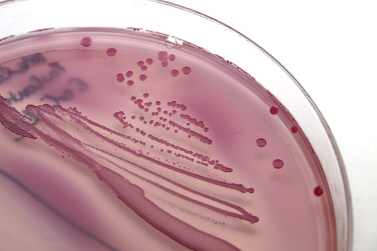 bacterial colonies