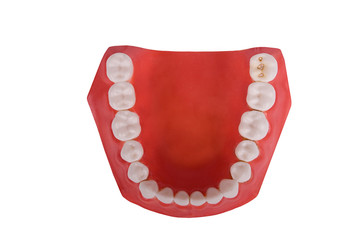 dentures, dental prosthesis