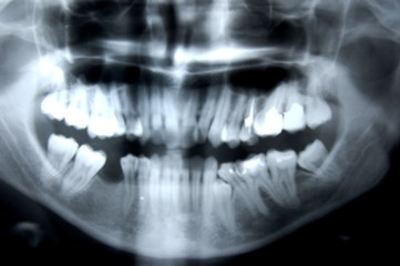 x-ray part 2