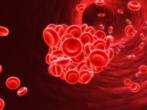 thrombose