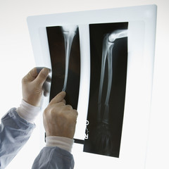 doctor pointing at an x-ray.