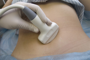 scanning of a stomach of the pregnant woman