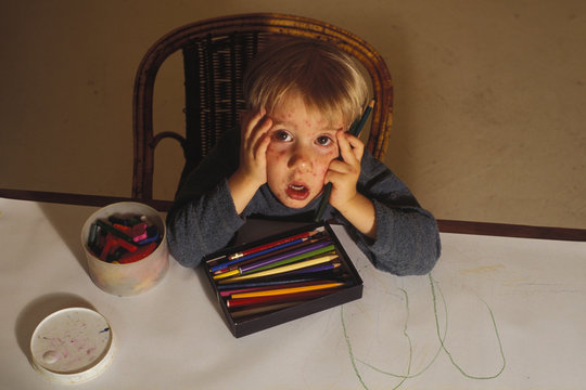 enfant varicelle