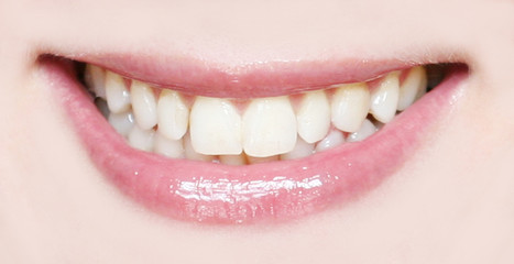 natural smile